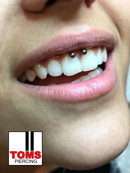 Lippenbändchen.2jpg